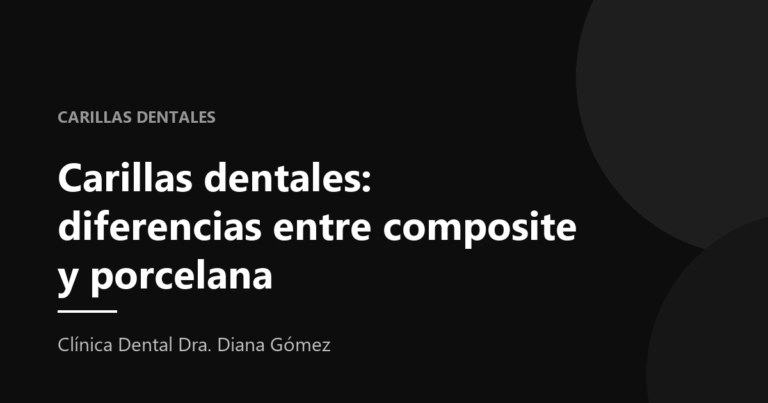 Portada del artículo «Carillas dentales: diferencias entre composite y porcelana» de la Clínica Dental Dra. Diana Gómez